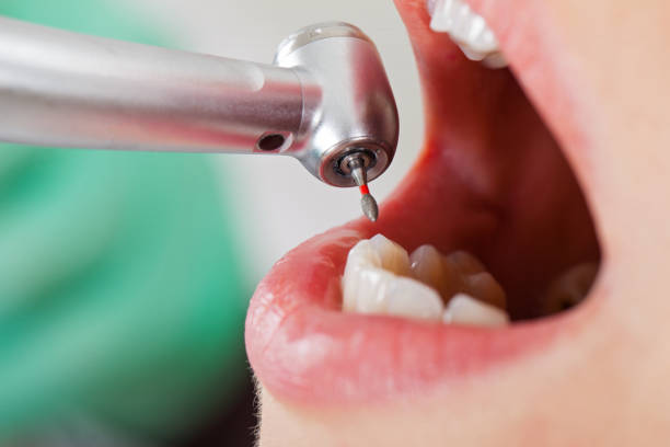 Best Emergency Pediatric Dental Care in Cerro Gordo, IL